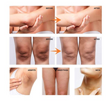 AsaVea Whitening Cream for Armpits, Intimate Parts, Between Legs - with Collagen - Effective Lightening Cream - Brightens, Nourishes, Moisturizes Underarm, Neck, Knees, Elbows